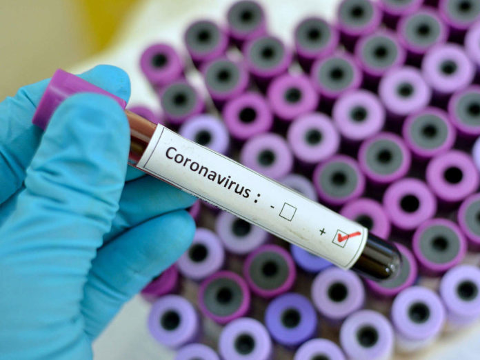 corona virus sample picture